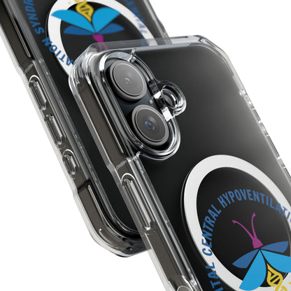 Congenital Central Hypoventilation Syndrome  Clear Magnetic Phone Case